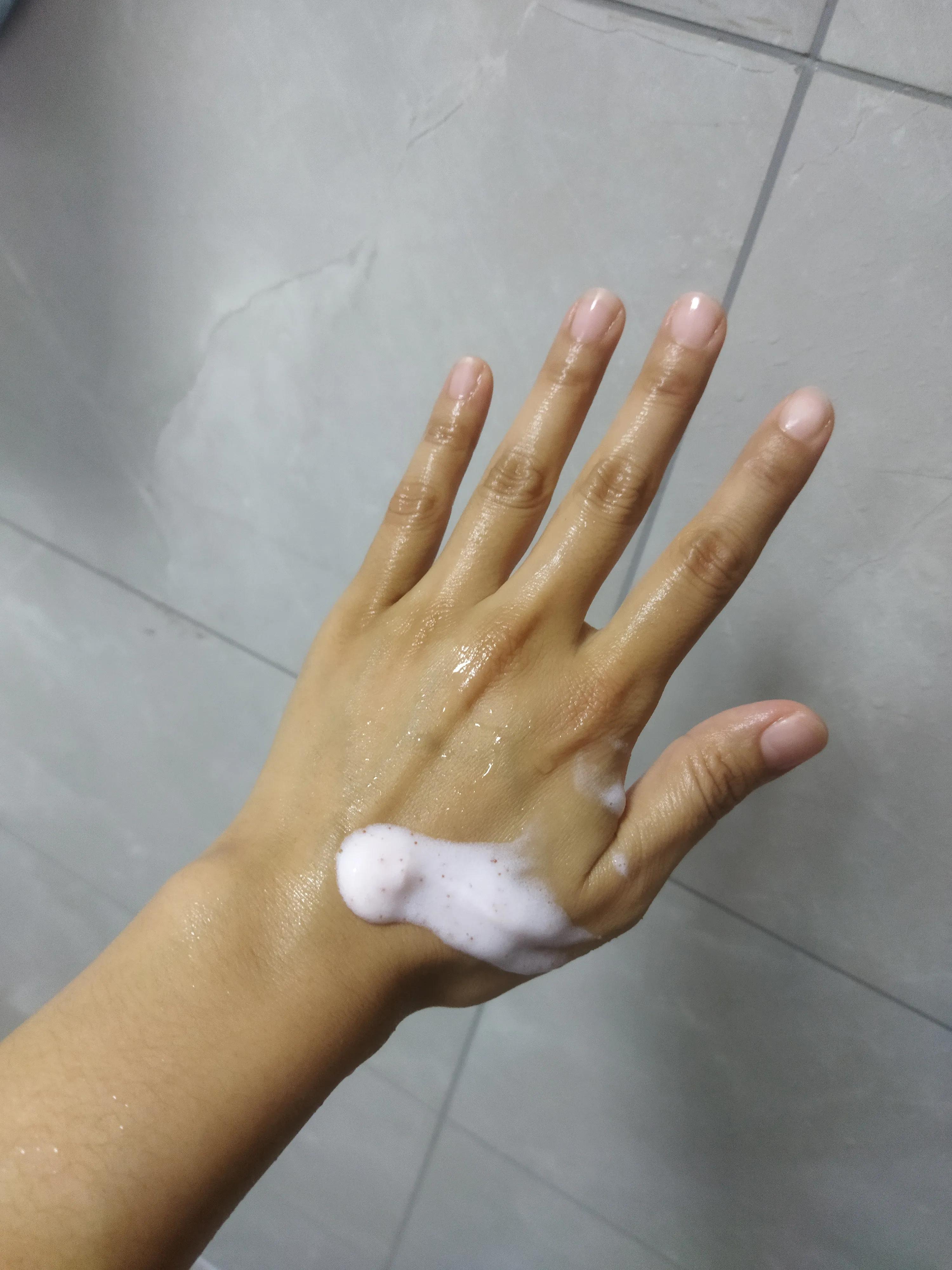 手肘膝盖发黑怎么治疗,手肘关节处变黑是什么原因