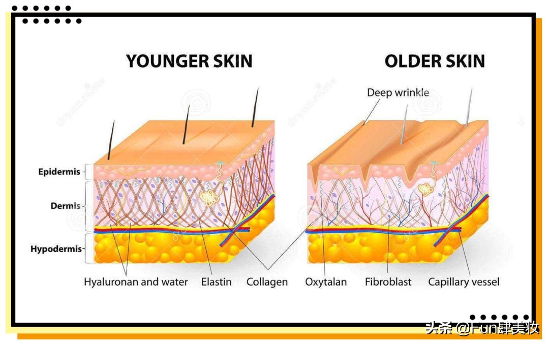 红痘印和红痘痘怎么祛,祛痘疤痘印痘坑最有效的方法