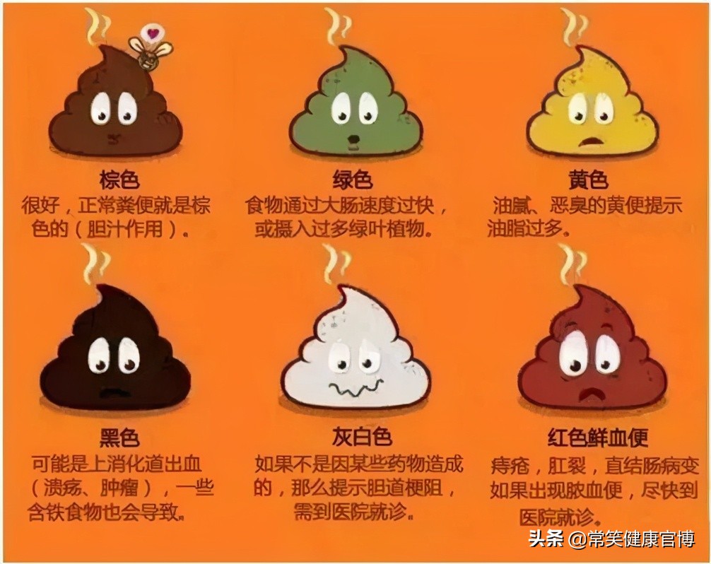 一次完美的拉屎是什么样子的？你很有可能不知道自己是不是便秘
