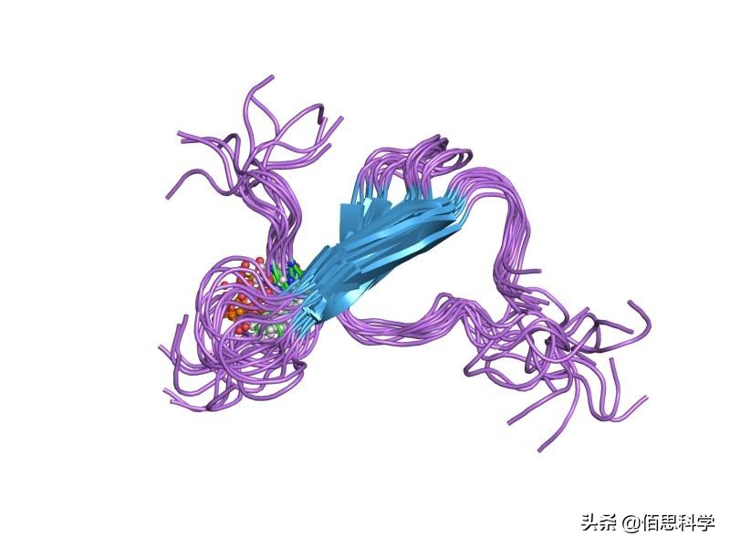 阿兹海默症跟失智症一样吗,阿兹海默病是帕金森吗