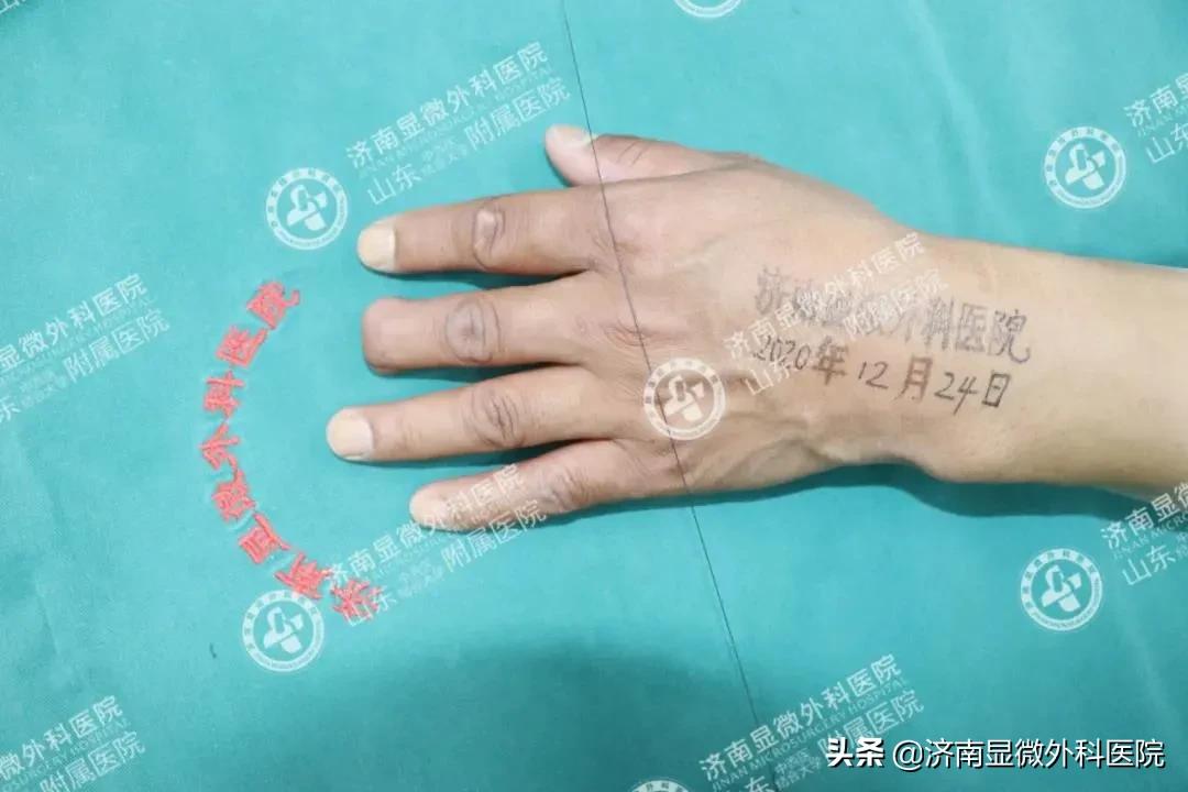 注意！失去一截手指不要灰心，这样做能重新复原它