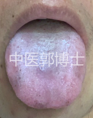 生完孩子一身病,生完孩子多久喝中药调理