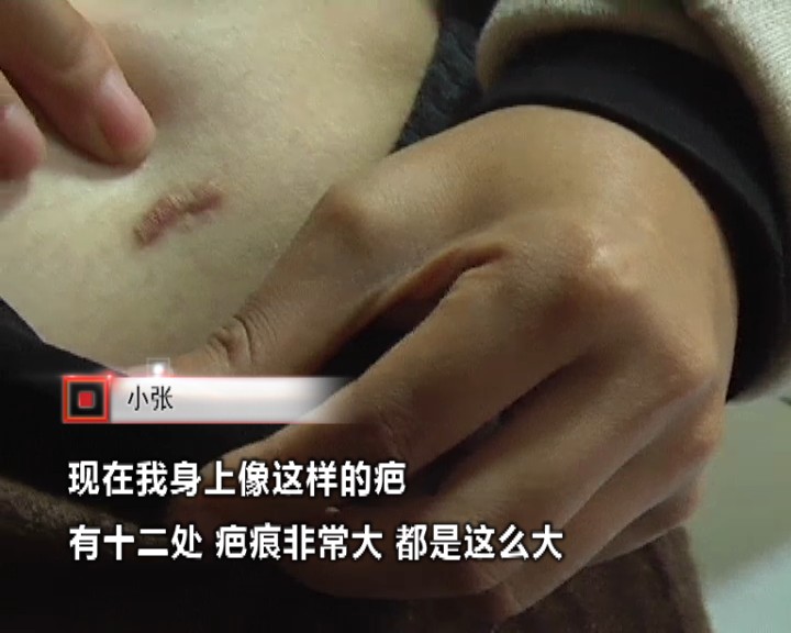 抽脂后身上掉皮,女子抽脂手术后凹凸不平