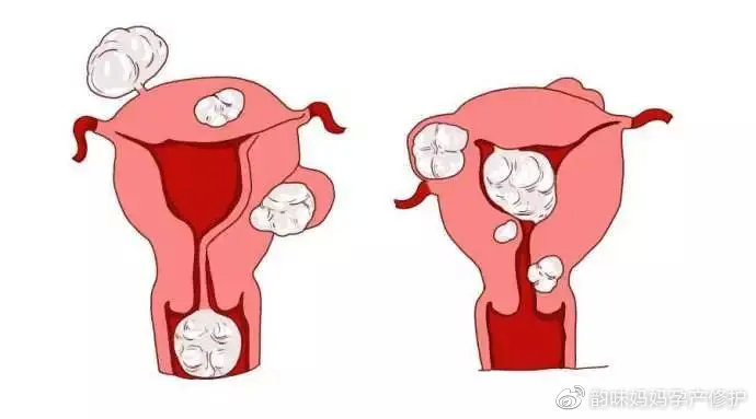 男性的4个行为很伤女性的子宫,最伤子宫的行为男性应熟知