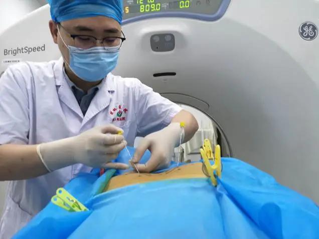 手汗症中医诊疗方案,手掌多汗症怎么治疗