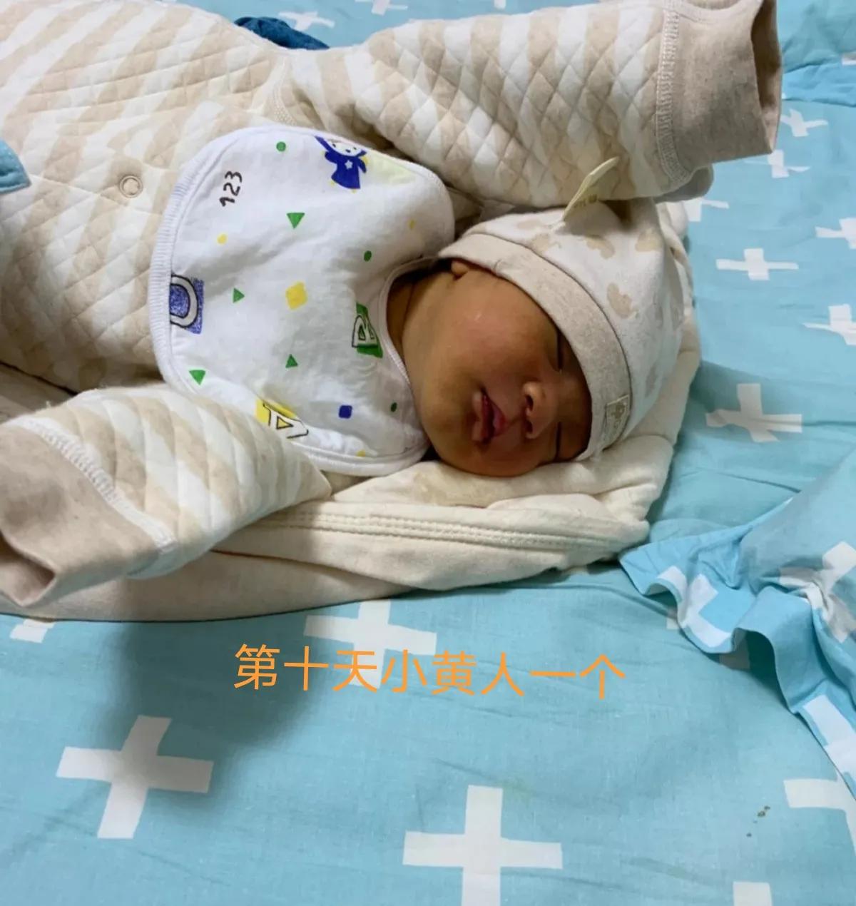 宝宝黄疸好转有哪些征兆,亲身经历宝宝黄疸过程