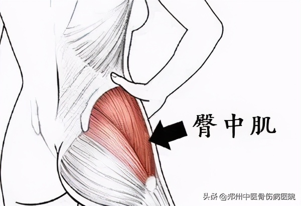 中医治疗股骨头坏死效果怎么样,中医是否可以治愈股骨头坏死