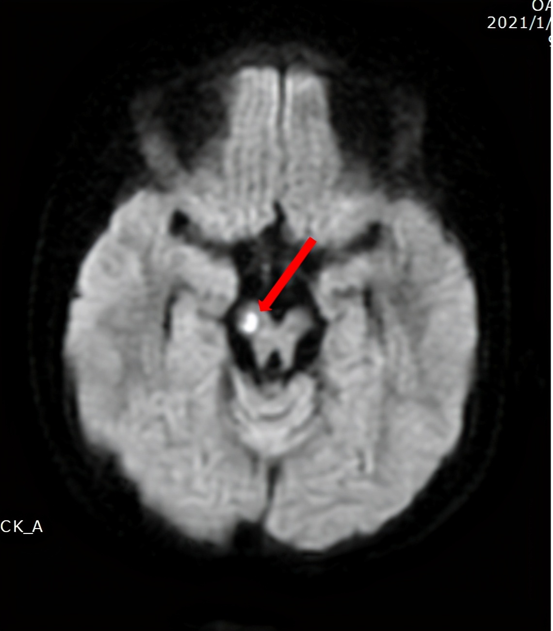 反复发烧儿童查不出原因,反复高烧查不出病因的案例
