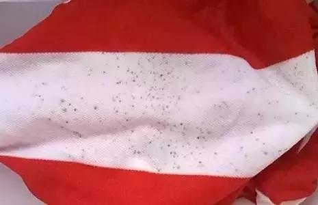 怎么去除衣物上的黑色霉点,衣物除霉剂去霉斑黑点