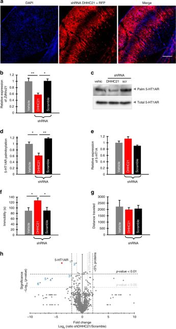 068期抑研报｜抗精神病药物如何影响患者大脑的结构？