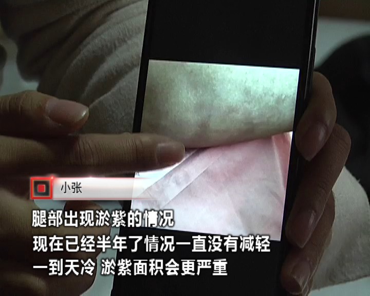 抽脂后身上掉皮,女子抽脂手术后凹凸不平