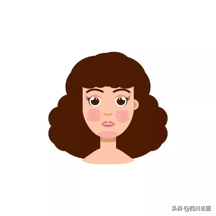 屠呦呦狼疮病的研究,屠呦呦研究出红斑狼疮药了吗