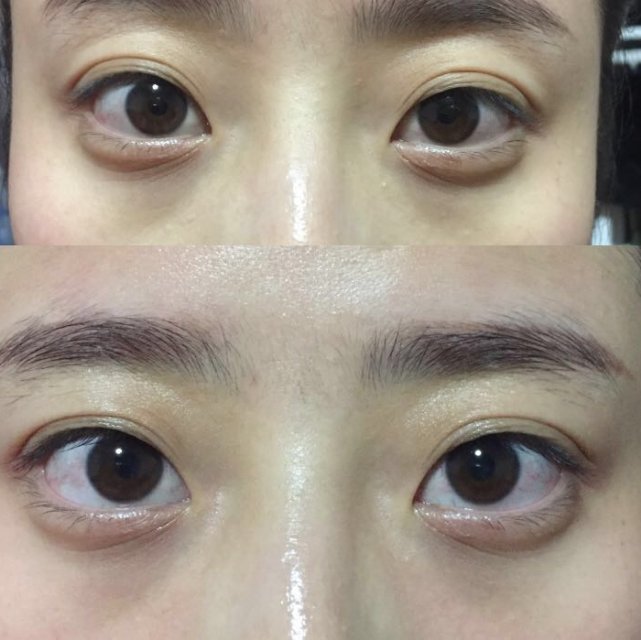 资生堂眼纹小熨斗眼膜使用方法,晓姿眼膜紧致淡化细纹