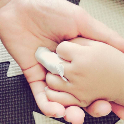 手指夹伤需要拔指甲吗,宝宝手指甲肿了怎么办