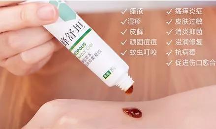 抗痘抑菌凝胶,祥顺比尔霍夫抑菌凝胶治理皮癣