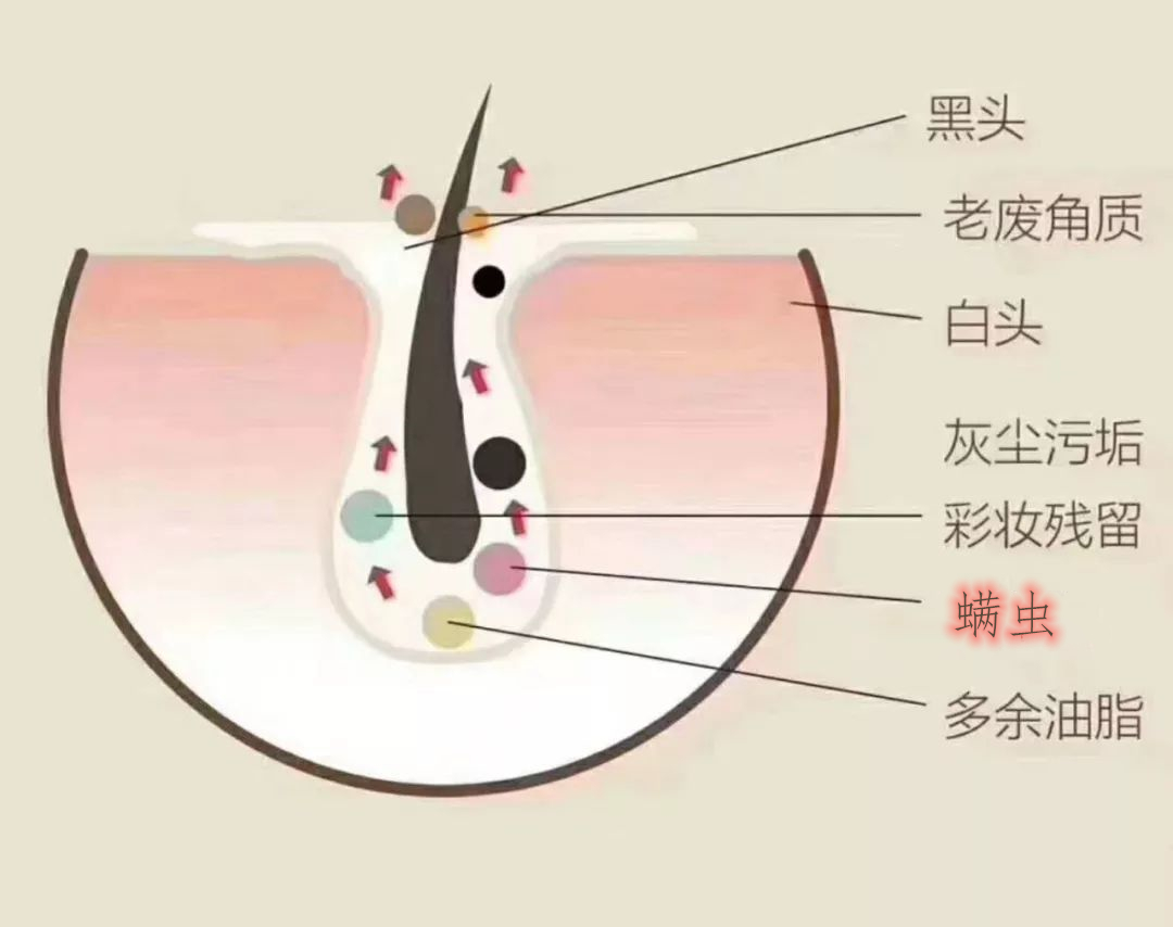 白天身上螨虫多是什么症状,身上螨虫多影响护肤吗