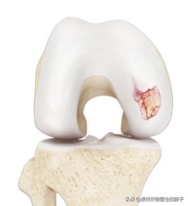 膝盖走路不怎么疼躺下就疼,儿童膝盖不动就不疼一走路就疼