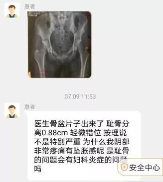 宝妈产后浑身痛怎么办,产后宝妈耻骨痛怎样缓解