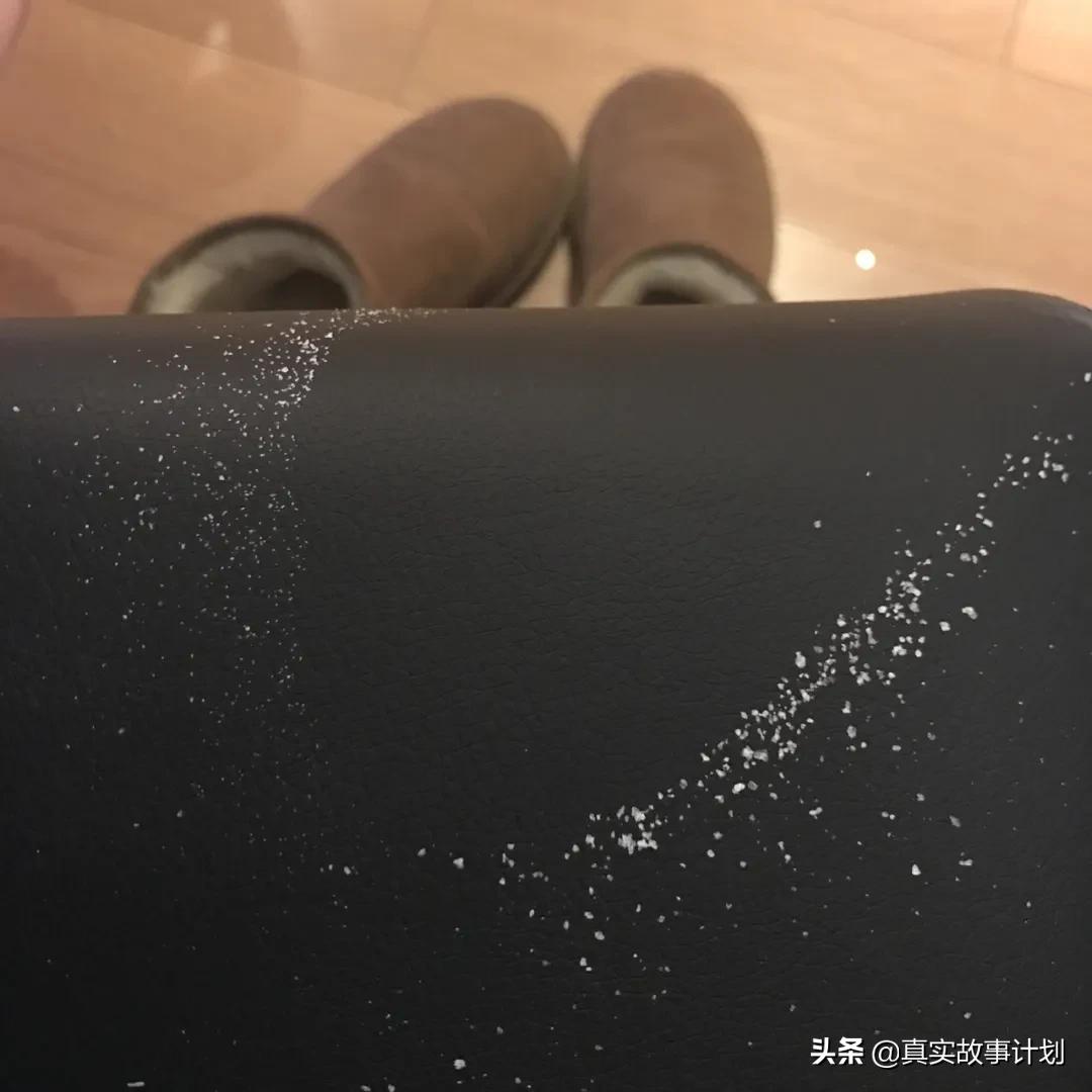 故事：暂别银屑病后，她想为自己拍一组裸照