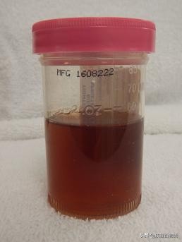 夏季炎热,狗狗便血而亡,元凶藏在这里!你家狗也会有