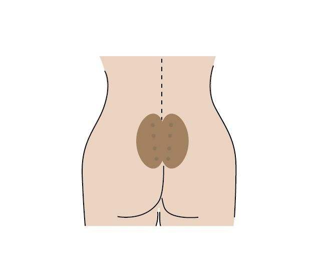 八髎穴原来有那么神奇的作用