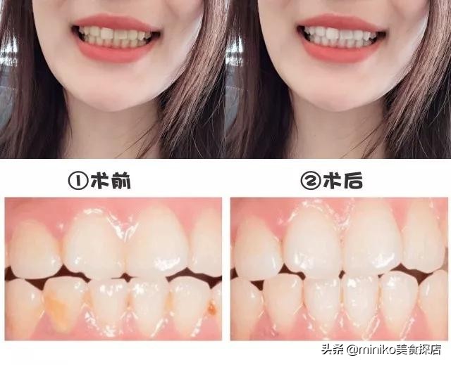 祛痘、脱毛、洗牙？点开这篇文章，离女神更近一步