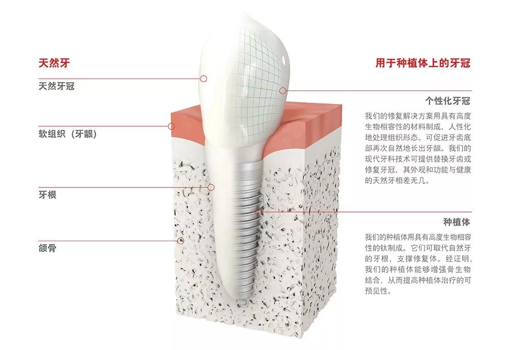 看牙又贵又遭罪,看牙那么贵没人管吗