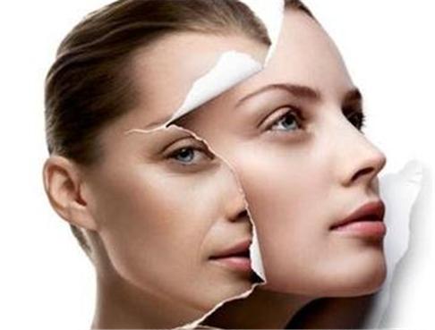 眼袋黑眼圈严重怎么治疗,眼袋黑眼圈怎么治