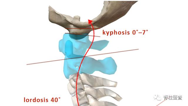查出颈椎多节病变,颈椎生理曲度稍变直能恢复吗