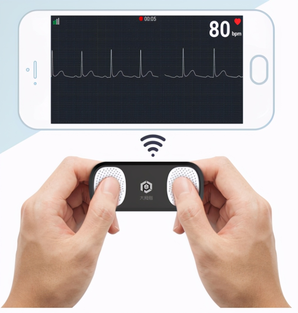 房颤的护理计划怎么写,房颤患者的管理案例