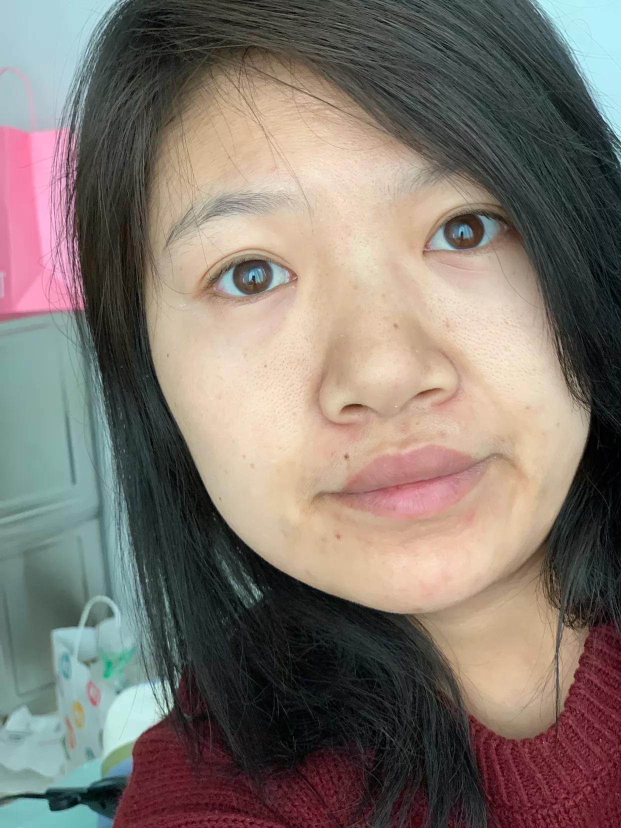 天生黑如何变白全身皮肤 (天生皮肤黑怎么调理能变白)