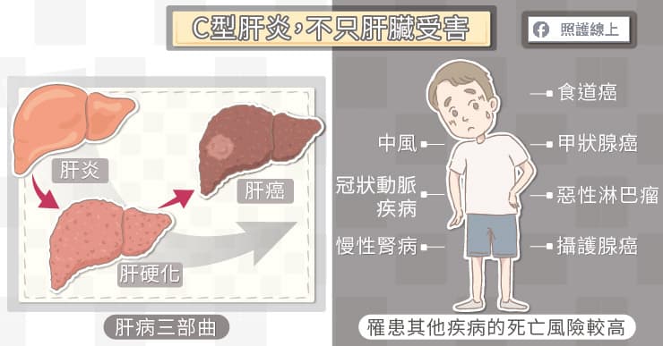 保护肝脏的五大注意事项,保护肝脏注意哪些事项
