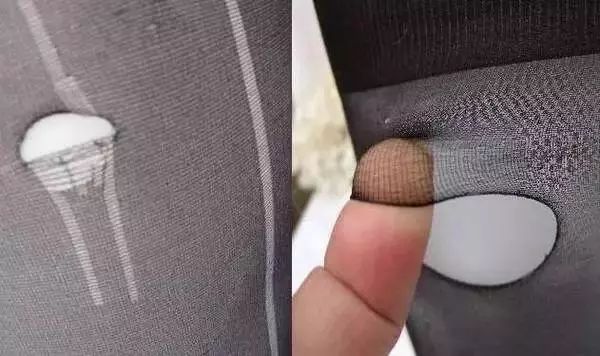 手脚干裂皮肤又厚又痒怎么办,冬天手脚干裂起皮怎么治疗