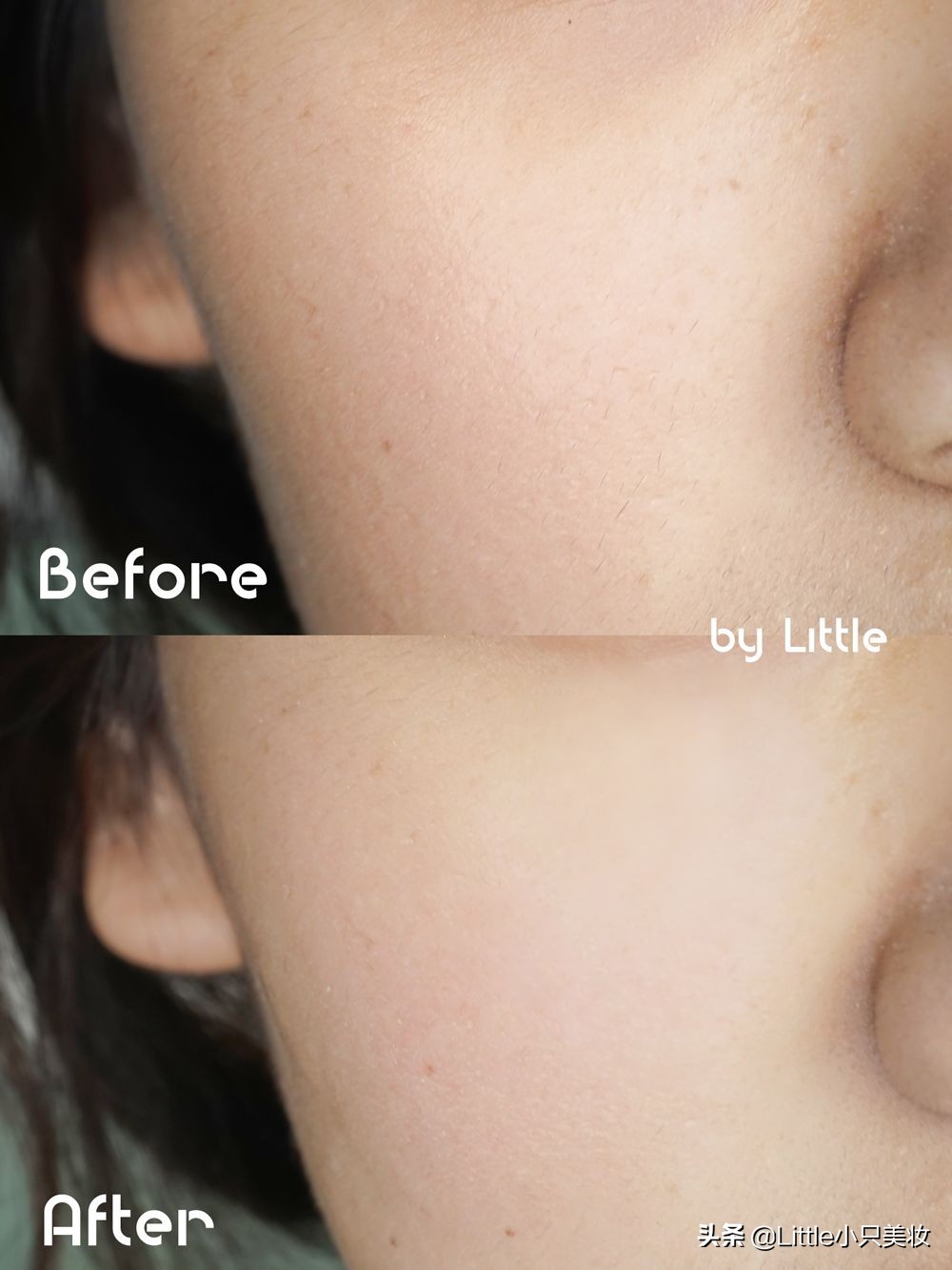 拯救小秘密,拯救毛孔粗大黑头粉刺