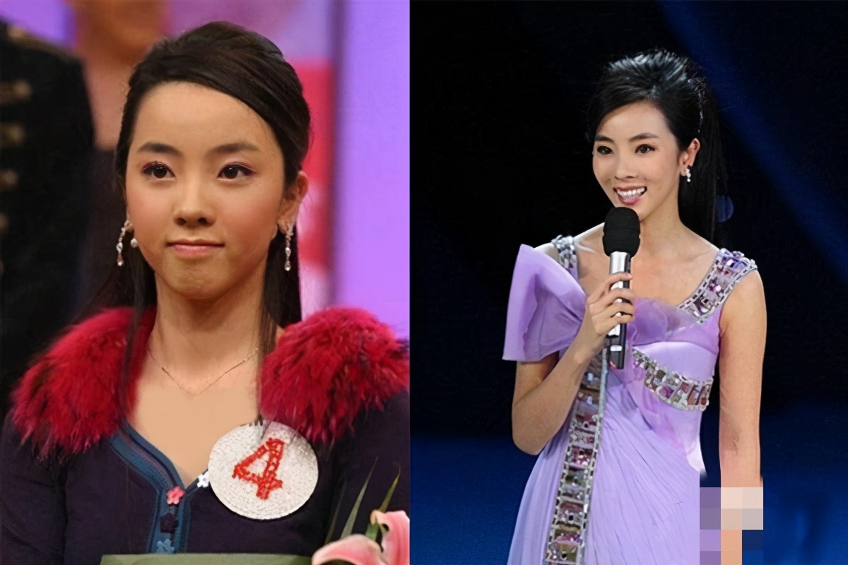 隆鼻对皮肤有什么影响,隆鼻对颜值有多大影响