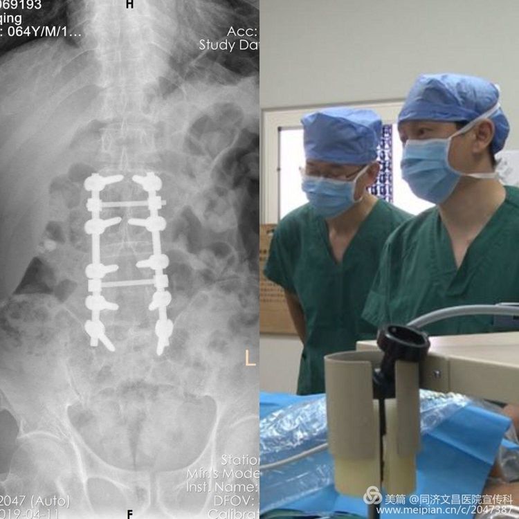 泌尿外科微创技术基层培训基地,专家下沉助力基层医疗水平提升