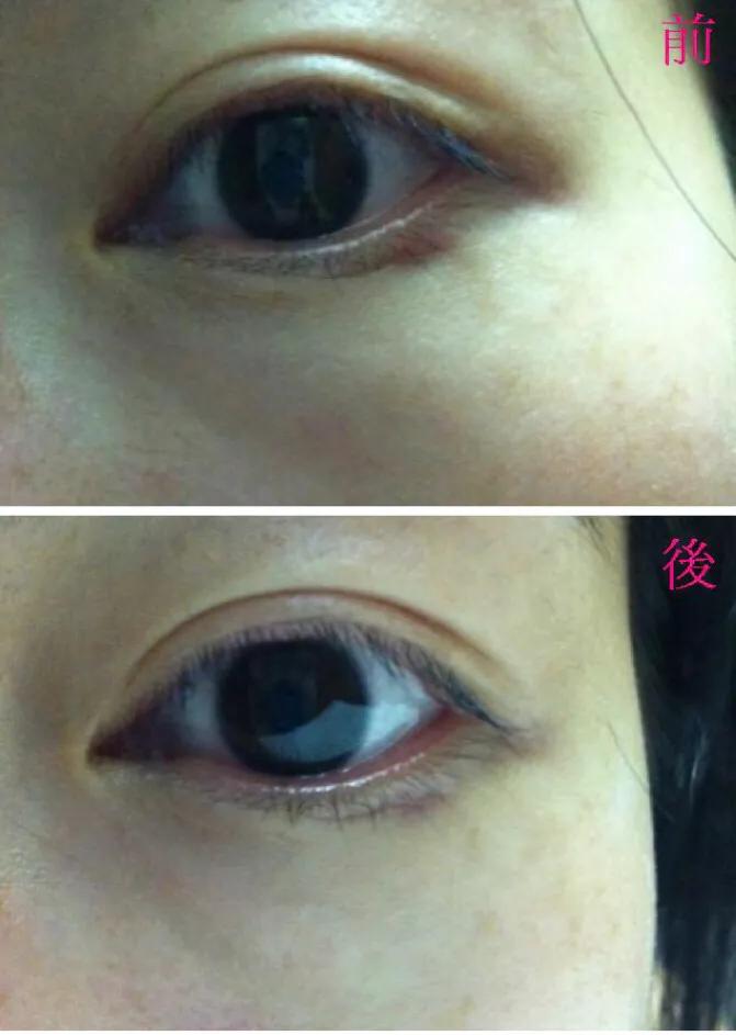 最好用的贵妇级眼霜,超厉害的眼霜推荐测评