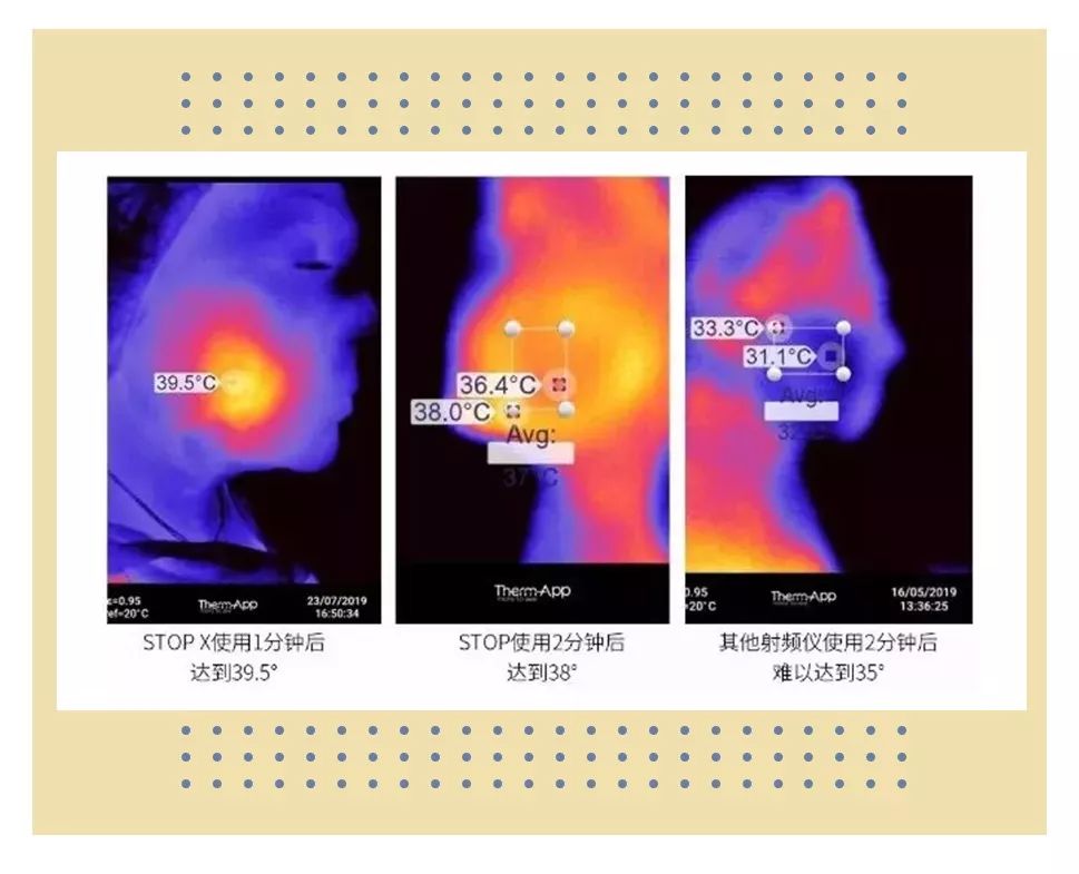 tripollarstop美容仪真假测评,tripollarstopeye测评