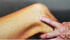 大腿外侧髂胫束综合征快速恢复,跑步如何避免髂胫束综合征