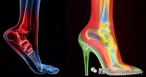 一个方法解决足跟痛,什么方法缓解足跟痛