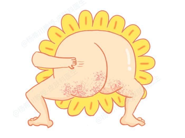 肛门瘙痒反复发作怎么办,肛门瘙痒老反复怎么办