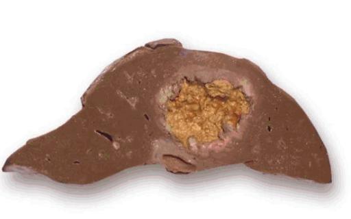 涨知识的问答视频,常用组织切片方法