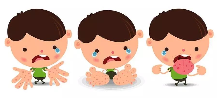 带状疱疹后神经痛的最佳治疗办法,带状疱疹性神经痛鉴别诊断