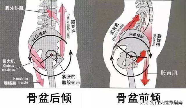 久坐骨盆前倾怎么纠正,久坐会导致骨盆前倾拉伸髂腰肌