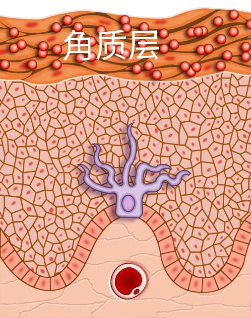 孩子手指脱皮不痒是怎么回事,手指脱皮儿童可用艾草水泡吗