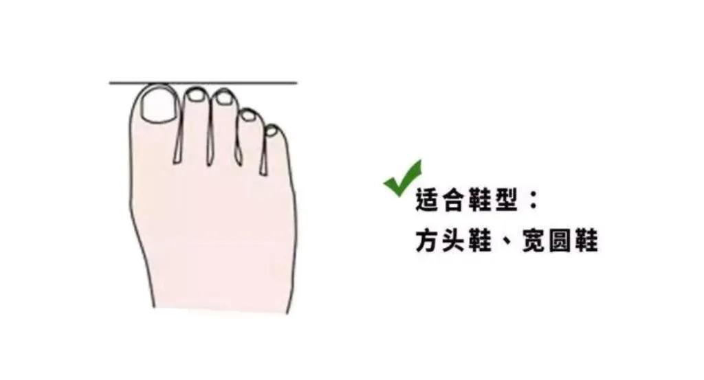 夏天穿凉鞋的季节，不懂脚型，选错鞋子又丑又磨脚！