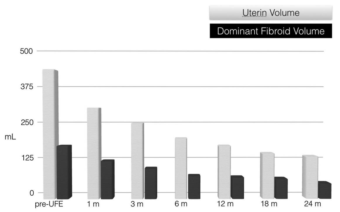 子宫肌瘤介入栓塞造影剂作用,子宫肌瘤介入栓塞有副作用吗