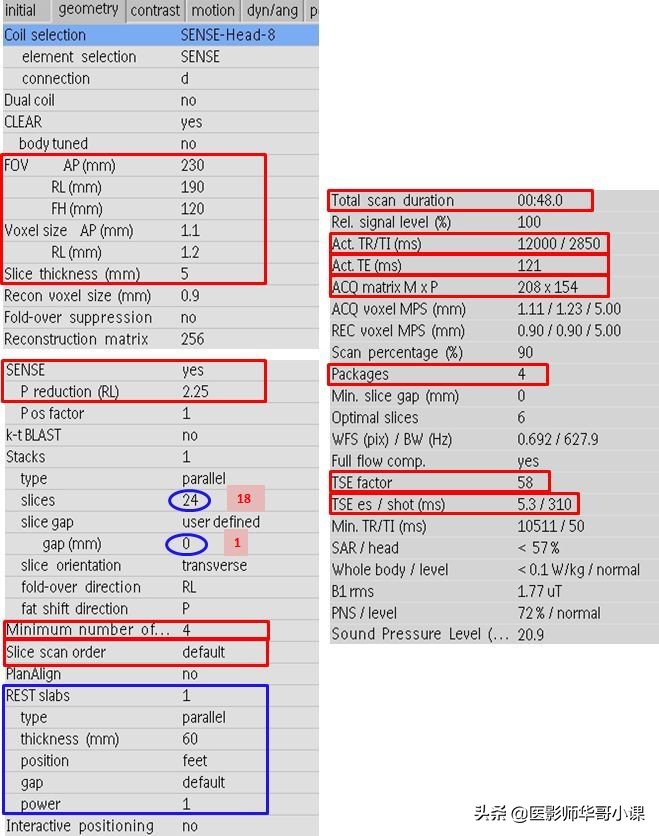 「MRI技术」磁共振伪影分析,了解下SSh_FLAIR序列