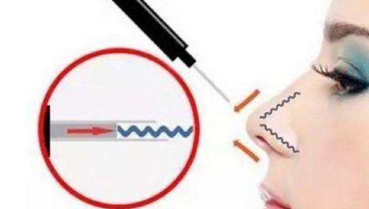 关于线雕隆鼻这些知识需要了解,线雕隆鼻技术讲解视频