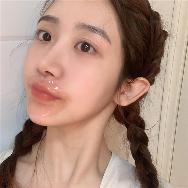 脸颊毛孔粗大怎么解决,脸颊毛孔粗大怎样解决